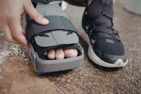 Rehabilitation After ACL Surgery:  ﻿A Step-by-Step Guide to Recovery